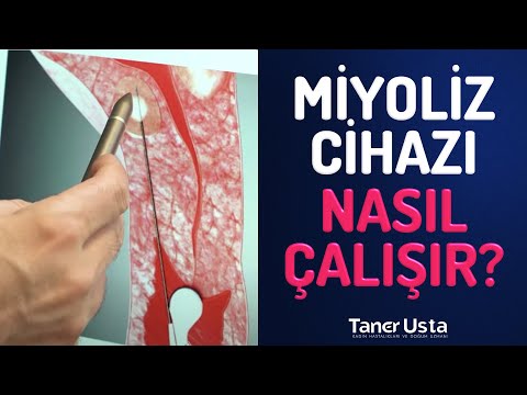 Miyom Cerrahisi - Prof. Dr. Taner Usta