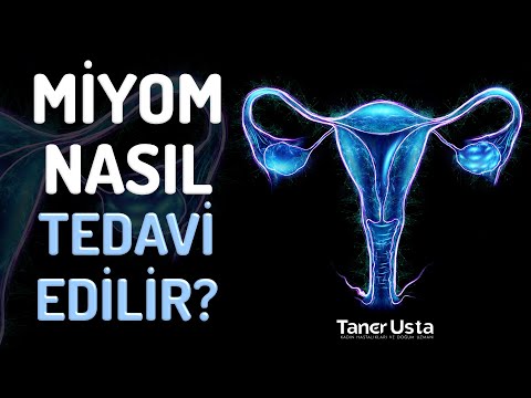 Miyom Cerrahisi - Prof. Dr. Taner Usta